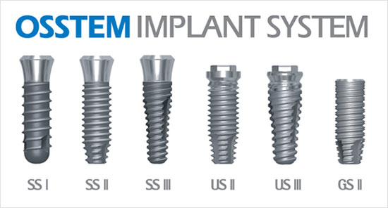 7 loại implant được sử dụng phổ biến tại Việt Nam