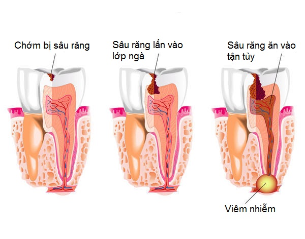 Bệnh lý răng miệng người Việt thường mắc phải