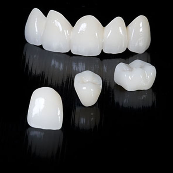 Kỹ thuật tạo sườn cho răng sứ Zirconia