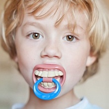 Các thói quen có thể gây lệch lạc răng hàm ở trẻ