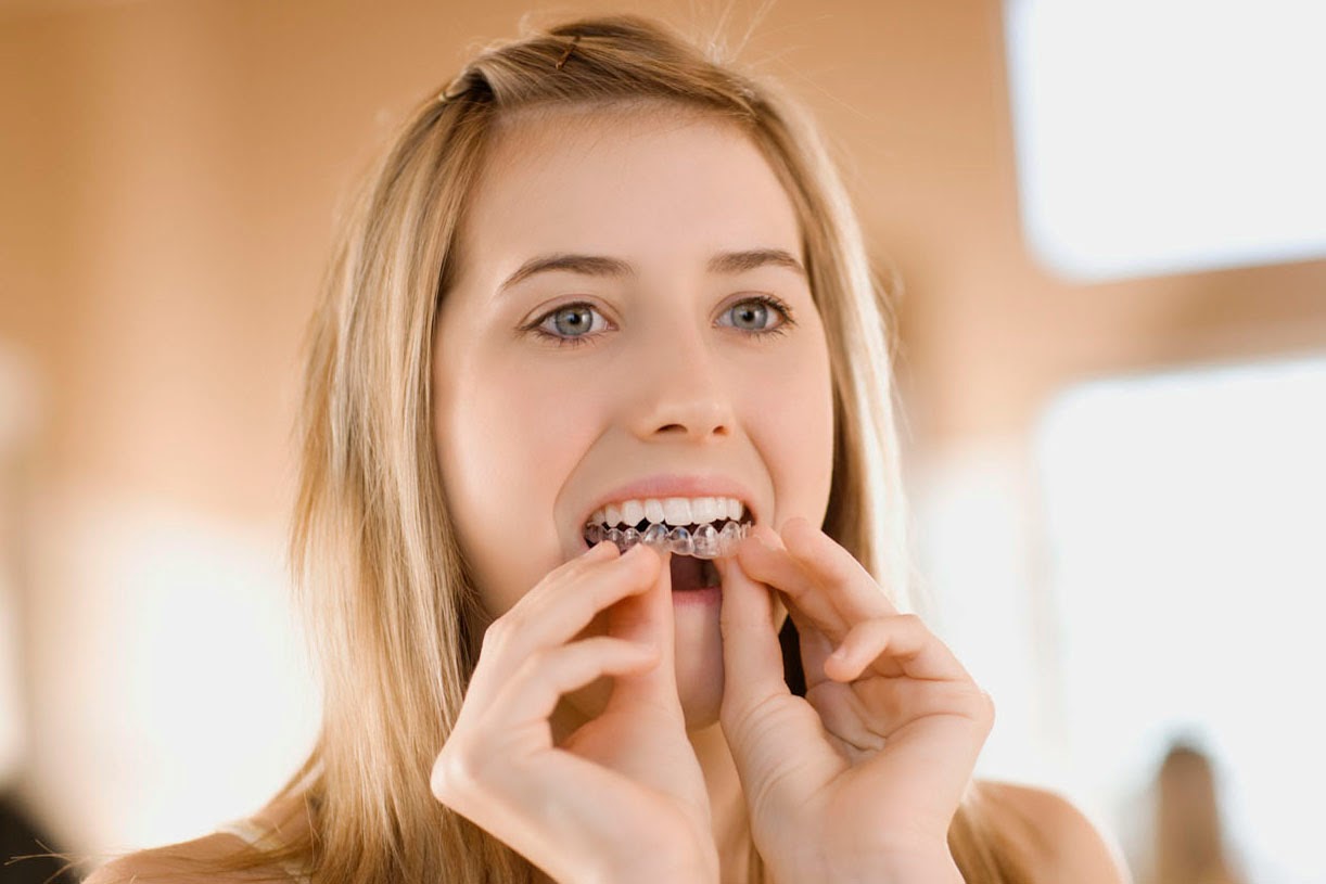 Cách chăm sóc răng miệng sau khi niềng răng