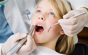 Có nên lấy cao răng cho trẻ em không