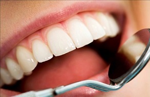 Công nghệ Laser Tech - Giải pháp trám răng tối ưu nhất 2016