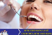 Diễn biến của bệnh áp xe răng