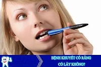 Khuyết cổ răng - Nguyên nhân và cách phòng ngừa