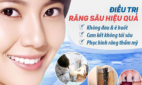 NHA KHOA LAM ANH