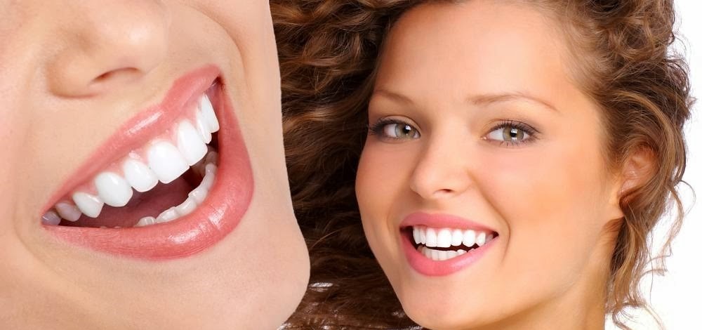 Những lợi ích khi bọc răng sứ mà bạn nên biết