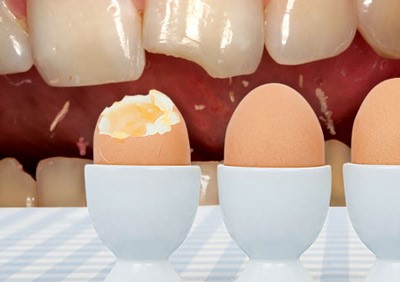 Những tác nhân “vô tình” hại men răng mà bạn không biết