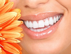 Những trường hợp không nên tẩy trắng răng