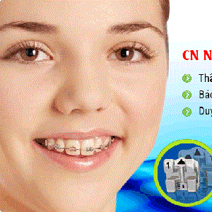 Niềng răng hô – Giải pháp cứu cánh cho người sở hữu hàm răng hô vẩu
