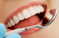 Niềng răng thưa – giải pháp cho răng thưa bẩm sinh và mới phát sinh
