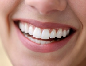 Phân tích hiện tượng viền nướu bị đen sau khi bọc răng sứ