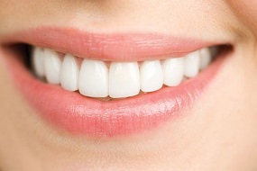 Sau nhổ răng bao lâu thì nên trồng lại răng