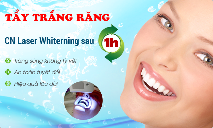 Tẩy trắng răng bằng công nghệ Laser Whitening tiên tiến nhất
