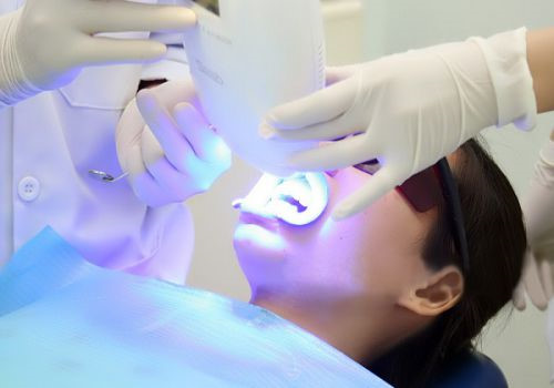 Tẩy trắng răng Uy Tín - Ưu Đãi Tháng 8 - Giảm 25%‎ đến 50%