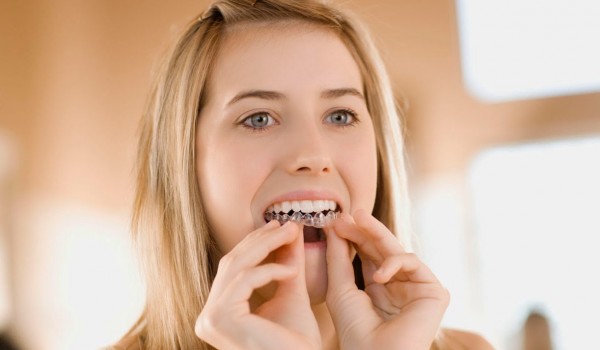 Cách chăm sóc răng miệng sau khi niềng răng