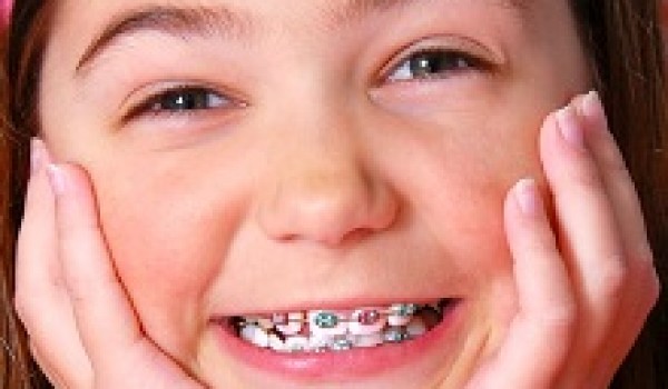 Chỉnh nha ở trẻ em có nhanh hơn ở người lớn không?