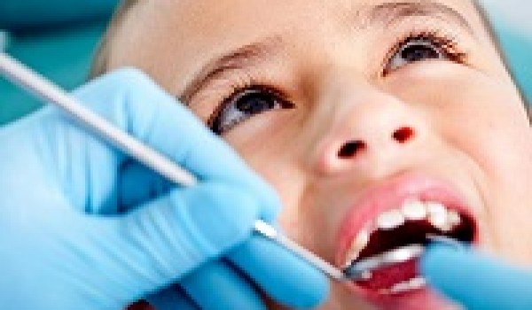 Chỉnh răng mọc lệch, không đều