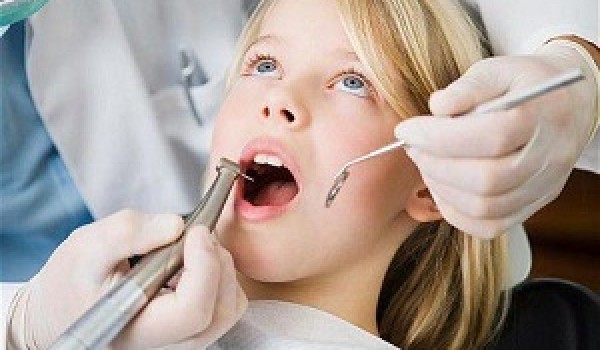 Có nên lấy cao răng cho trẻ em không