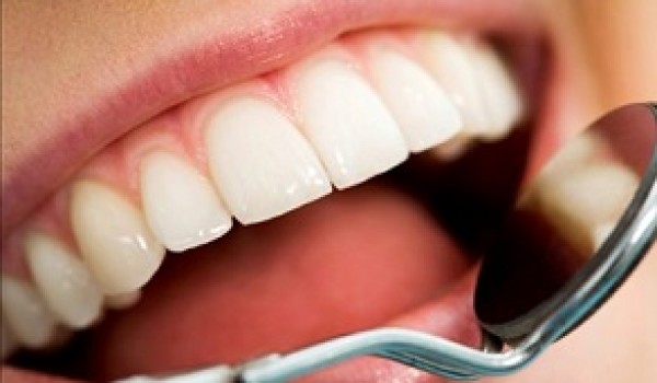 Công nghệ Laser Tech - Giải pháp trám răng tối ưu nhất 2016