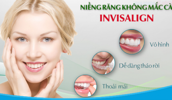 Đặc điểm và cách niềng răng hô hàm dưới