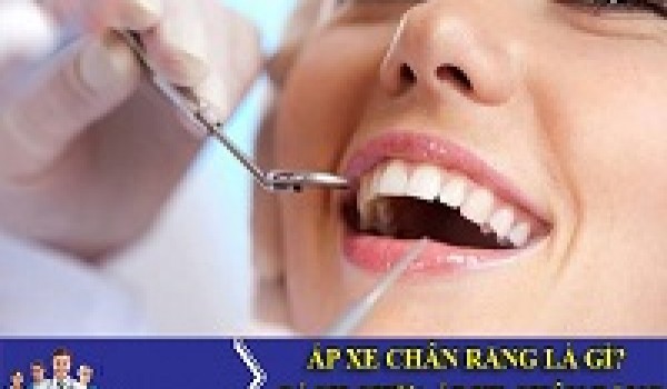 Diễn biến của bệnh áp xe răng
