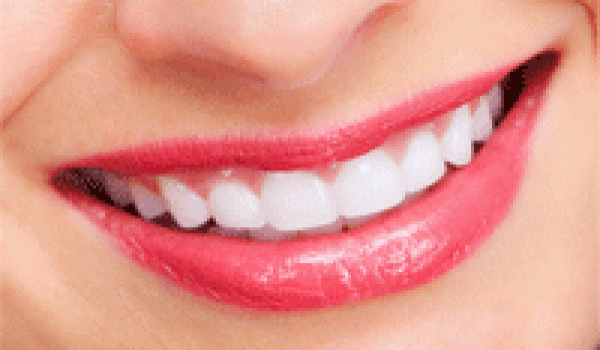 Hai phương pháp trồng răng sứ thẫm mỹ phổ biến hiện nay