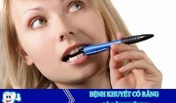 Khuyết cổ răng - Nguyên nhân và cách phòng ngừa