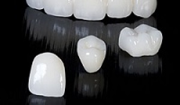 Kỹ thuật tạo sườn cho răng sứ Zirconia