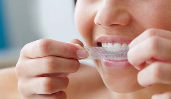 Miếng dán làm trắng răng và những điều cần biết