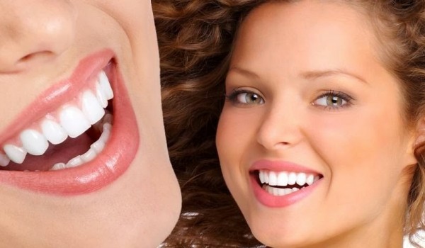 Những lợi ích khi bọc răng sứ mà bạn nên biết