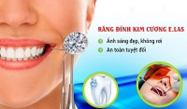 Những thắc mắc thường gặp về răng đính đá