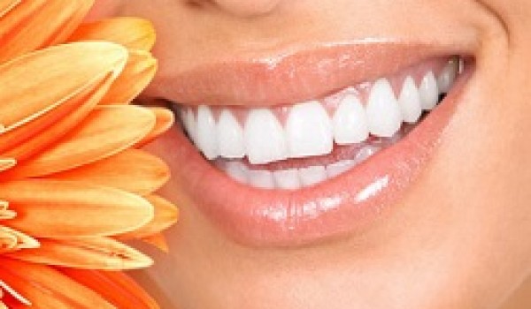 Những trường hợp không nên tẩy trắng răng