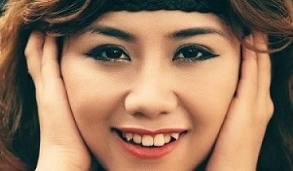 Niềng 2 răng khểnh mất thời gian bao lâu