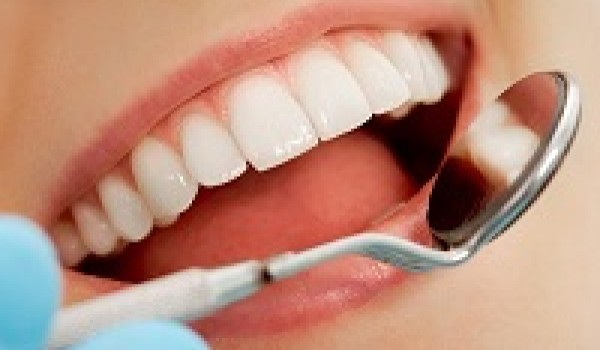 Niềng răng thưa – giải pháp cho răng thưa bẩm sinh và mới phát sinh