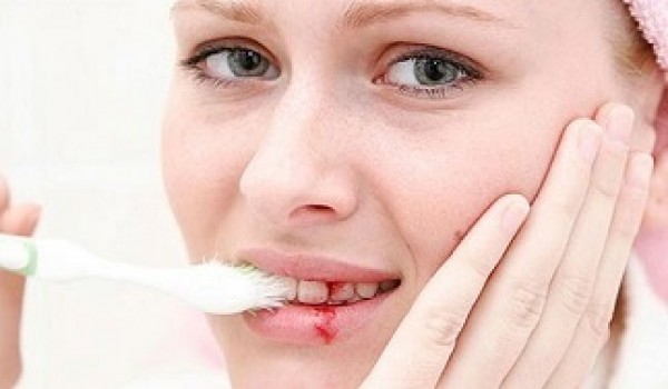 Phân tích hiện tượng chảy máu chân răng ở phụ nữ mang thai