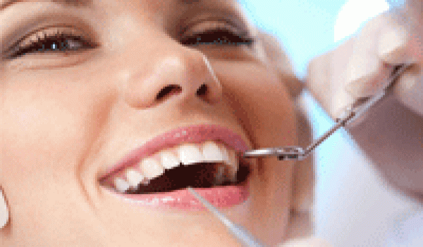 Quy trình thực hiện cạo vôi răng