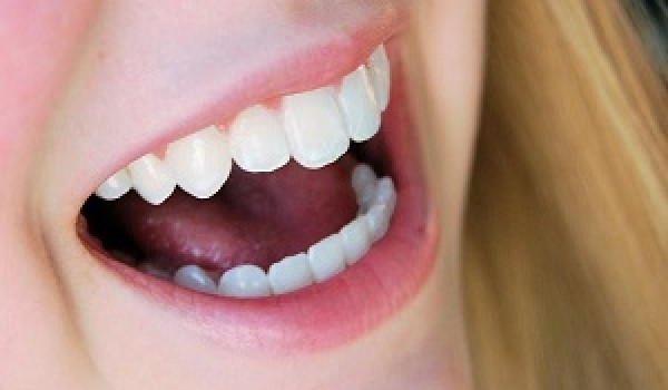 Răng sứ Cercon HT sự lựa chọn hàng đầu trong bọc răng sứ