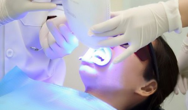 Tẩy trắng răng Uy Tín - Ưu Đãi Tháng 8 - Giảm 25%‎ đến 50%