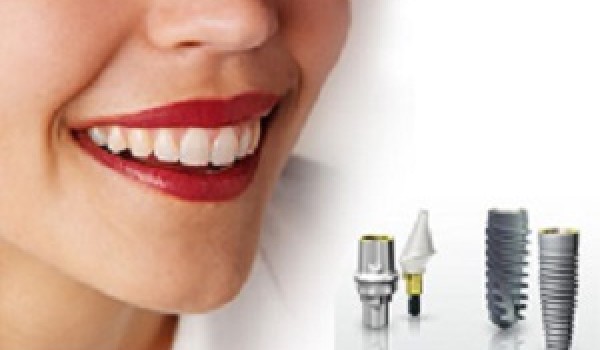 Tiêu xương ảnh hưởng gì trong cấy ghép răng implant