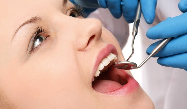 Trám răng có bền không, miếng trám có bị đổi màu?
