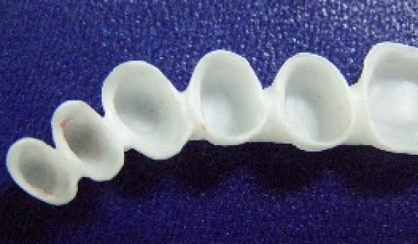 Ưu điểm vượt trội của Răng sứ E.MAX và Răng sứ Cercon